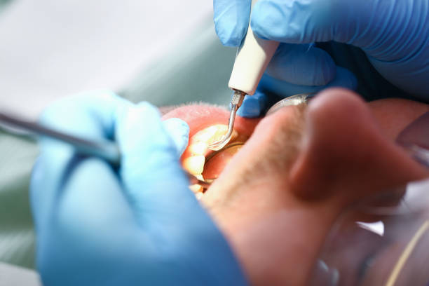Best Holiday Emergency Dentist in Reidsville, NC
