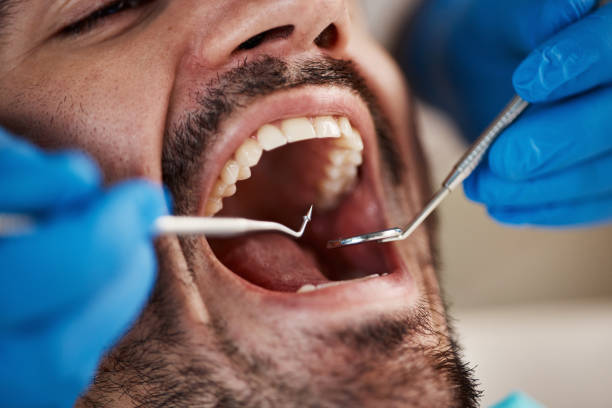 Best 24-Hour Emergency Dentist in Reidsville, NC